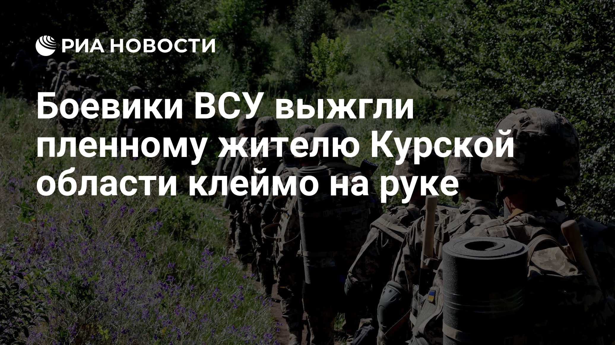 Солдаты ВСУ выжгли пленному жителю Курской области клеймо на руке