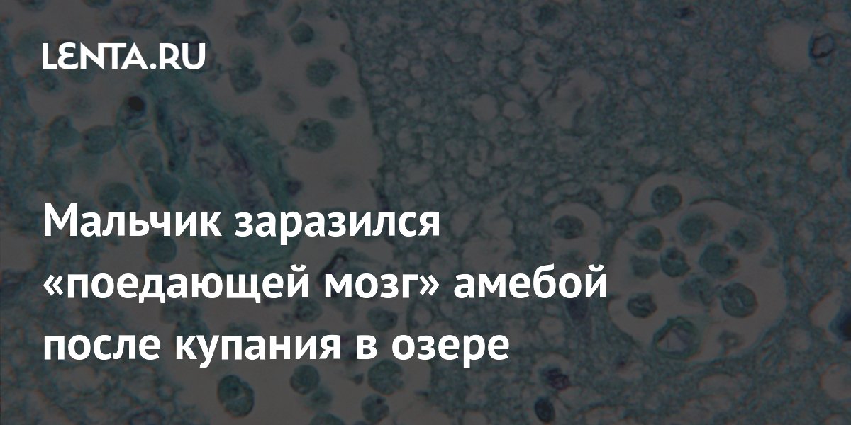 В Израиле ребенок заразился поедающей мозг амебой после купания в озере
